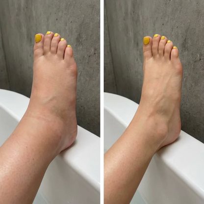 DRENAGGIO LINFATICO